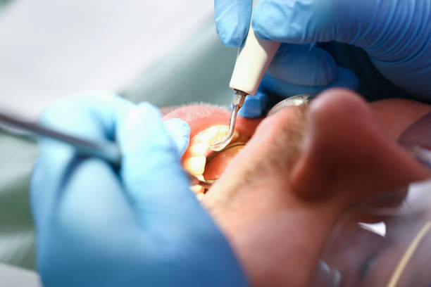 Best Emergency Gum Pain Relief  in Clinton, MS