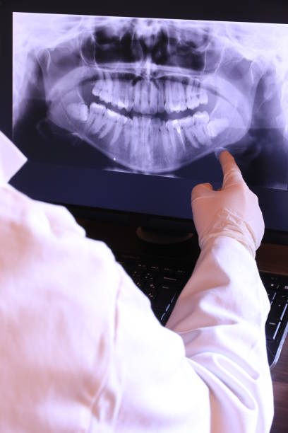 Best Root Canal Emergency Dentist  in Clinton, MS